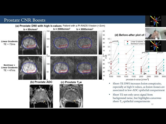 Contrast and Spatial Encoding with Nonlinear Gradients