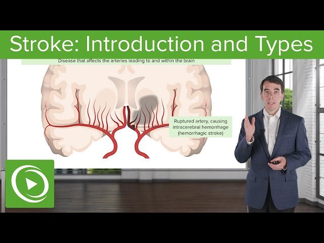 Clinical Neurology - USMLE Prep Videos