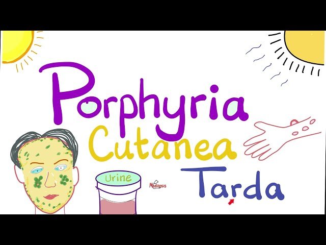 Porphyria Cutanea Tarda - Cause, Symptoms, Diagnosis and Treatment