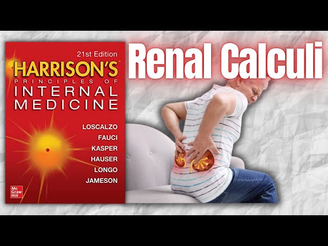 Nephrolithiasis - Risk Factors, Clinical Features, and Management