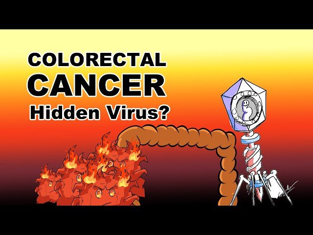Colorectal Cancer - Did They Just Find the Real Trigger?