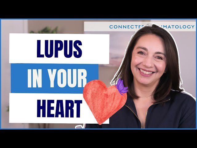 How Lupus Silently Affects Your Heart - Are You at Risk?