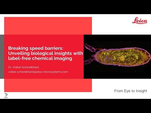 Breaking Speed Barriers - Unveiling Biological Insights with Label-Free Chemical Imaging