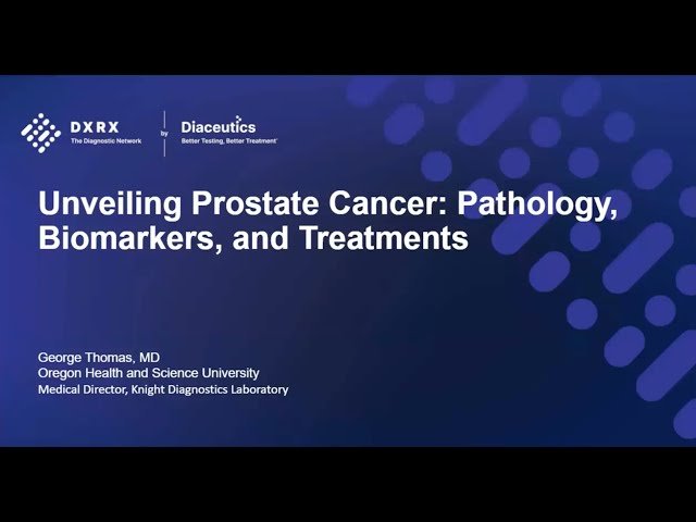 Unveiling Prostate Cancer - Pathology, Biomarkers, and Treatments