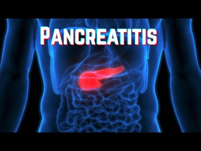 Pancreatitis - Medical Review
