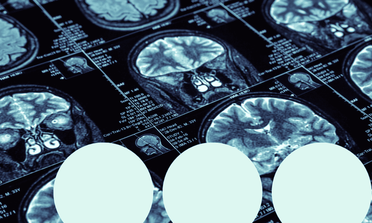 Learning and memory in the brain: a guide for teachers