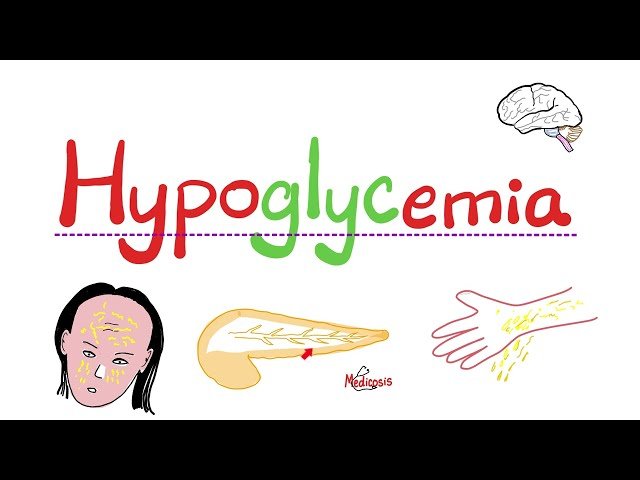 Low Blood Sugar (Hypoglycemia) - Endocrinology Series