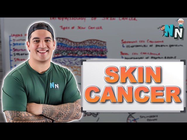 Skin Cancer - Clinical Medicine