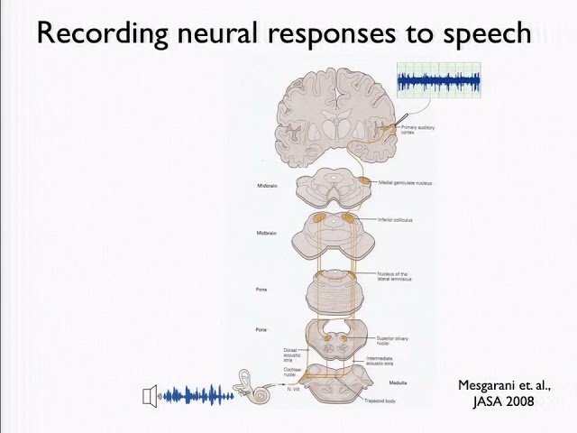 Robust Representation of Attended Speech in Human Brain with Implications for ASR