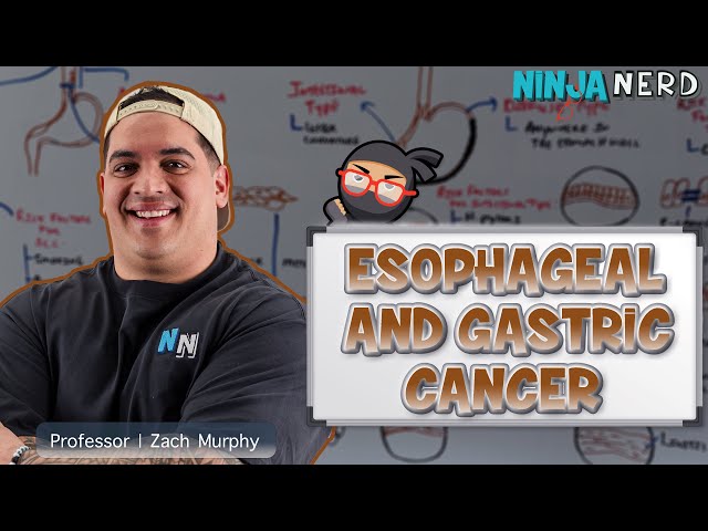 Esophageal and Gastric Cancer - Clinical Medicine
