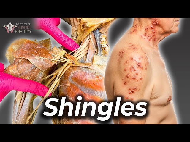 How the Shingles Virus Stays Dormant in Your Body for Decades