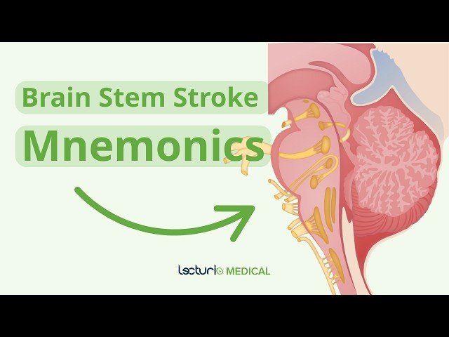 How to Ace Brain Stem Stroke Questions - USMLE Prep