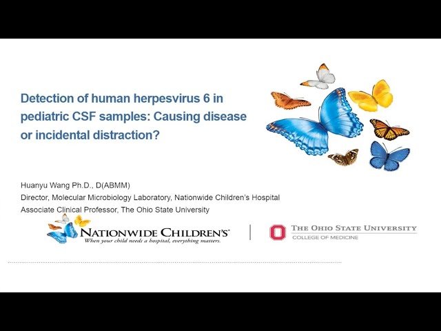 Detection of Human Herpesvirus 6 in Pediatric CSF Samples - Causing Disease or Incidental Distraction