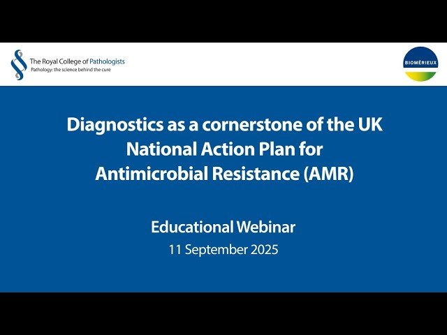 Diagnostics as a Cornerstone of the UK National Action Plan for Antimicrobial Resistance