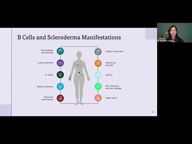 CAR T and Other Cellular Therapies for Scleroderma