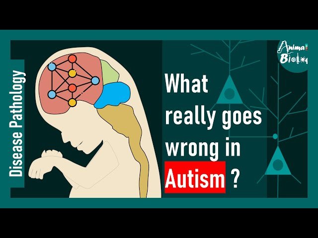 What Really Goes Wrong in Autism Spectrum Disorder - The Neurobiology of ASD