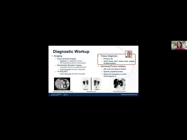 Neuroendocrine Cancer - Center for GI Cancers Webinar Series