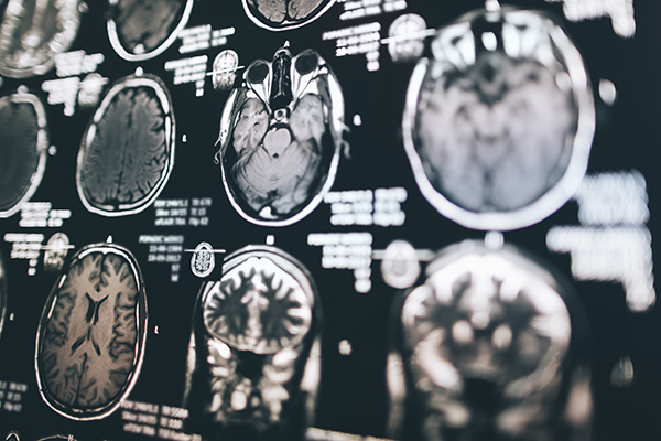 AI in Medical Imaging