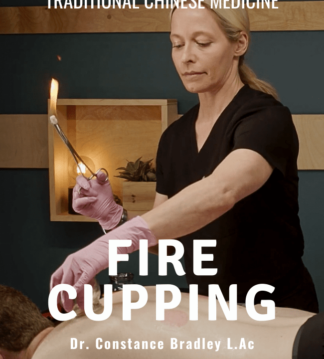 TCM Fire Cupping