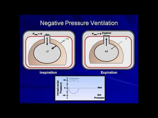 Mechanical Ventilation - Complete Course for Medicine Residents