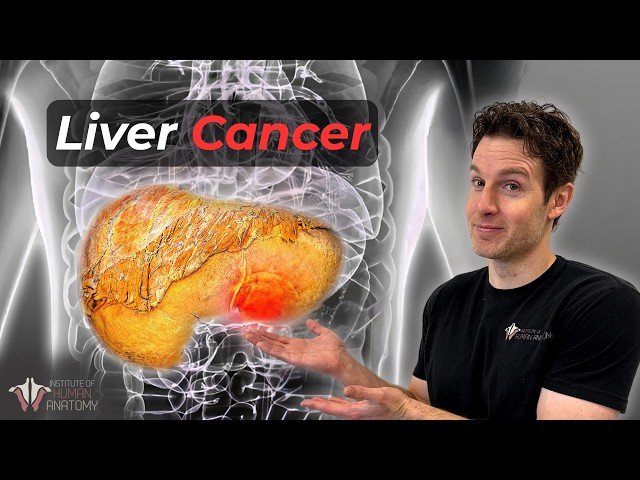 The Liver Cancer You Didn't See Coming — And Why It's So Deadly