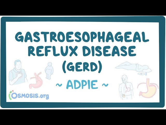 Gastroesophageal Reflux Disease (GERD) - Nursing Process (ADPIE)