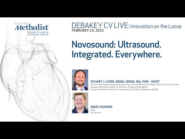 Novosound: Ultrasound Integrated Everywhere