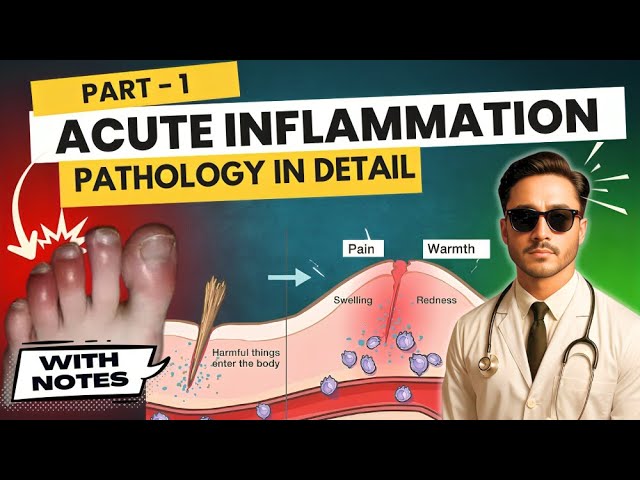 Acute Inflammation Pathology - Differences Between Acute and Chronic Inflammation in General Pathology