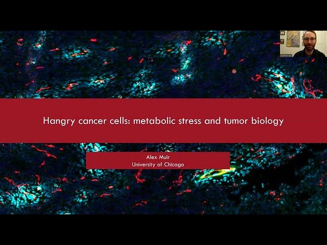 Hangry Cancer Cells - Metabolic Stress and Tumor Biology