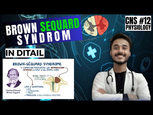 Brown-Séquard Syndrome: Hemisection of Spinal Cord Physiology and Lesions