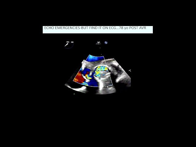 Cardiac Emergencies - Multi-Modality Imaging Weekly Webcast