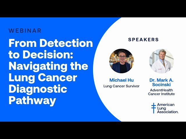 From Detection to Decision - Navigating the Lung Cancer Diagnostic Pathway