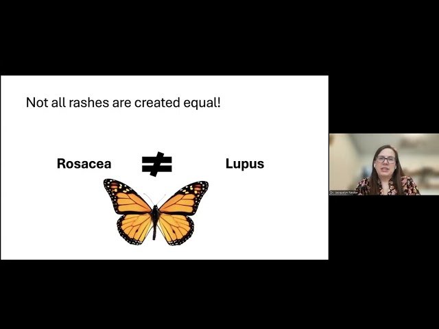 Lupus - An Evolving Landscape