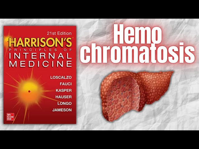 Hemochromatosis - Pathophysiology, Clinical Features, Diagnosis and Management