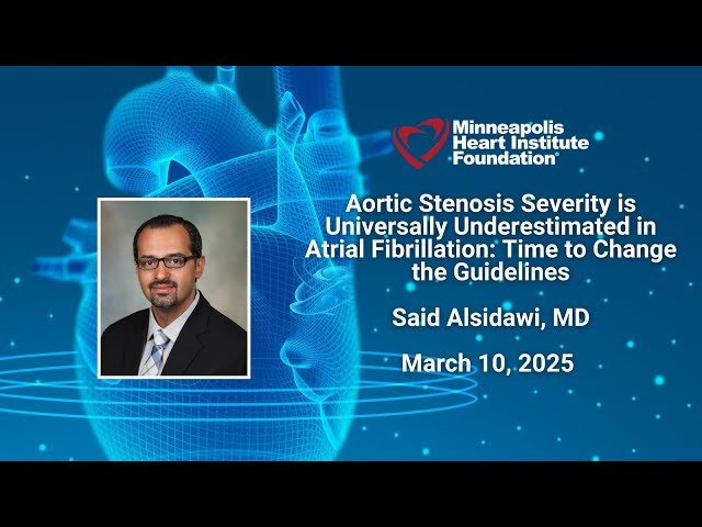 Aortic Stenosis Severity is Universally Underestimated in Atrial Fibrillation