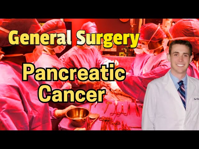 Pancreatic Cancer - Medical Review Series - 2025 Update