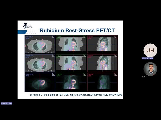 New Physics and AI Models for Rubidium PET in Cardiovascular Diseases