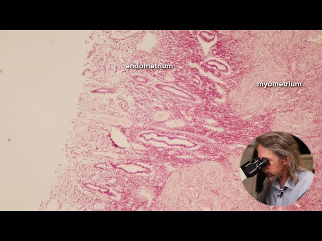 Microscopic Anatomy of the Uterus - Structure, Function and Cyclic Changes