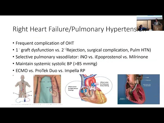Peri and Postoperative Care