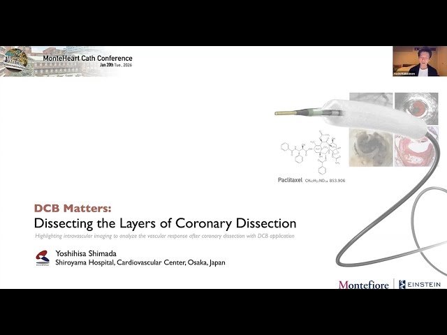 IVUS Evaluation of Dissections and Healing