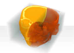 Image Processing: 3D Data and Volumetric Rendering: Wolfram U Lesson