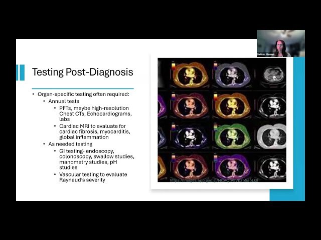 Fostering a Well-Lived Life With Scleroderma