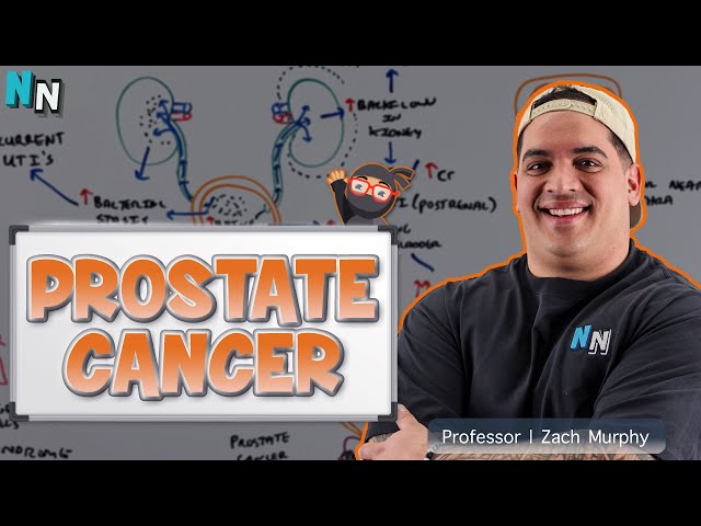 Prostate Cancer - Clinical Medicine