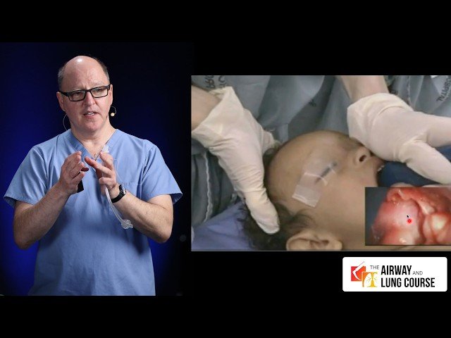 Pediatric Video Laryngoscopy Case Review - Emergency Airway Management