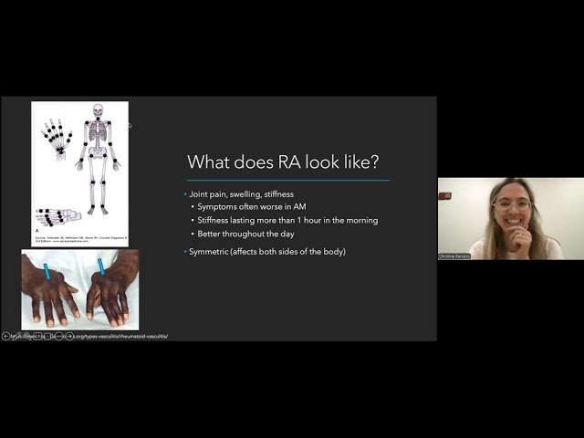 Inflammation Explained - Understanding Rheumatoid Arthritis