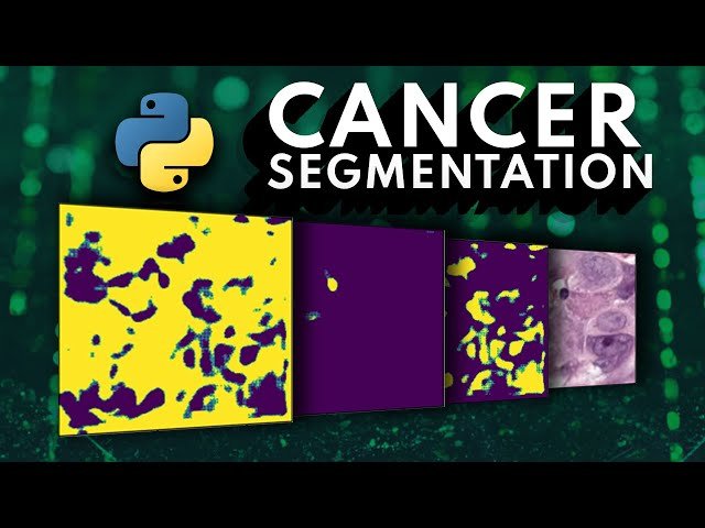 Building an ML Cancer Segmentation API in 15 Minutes