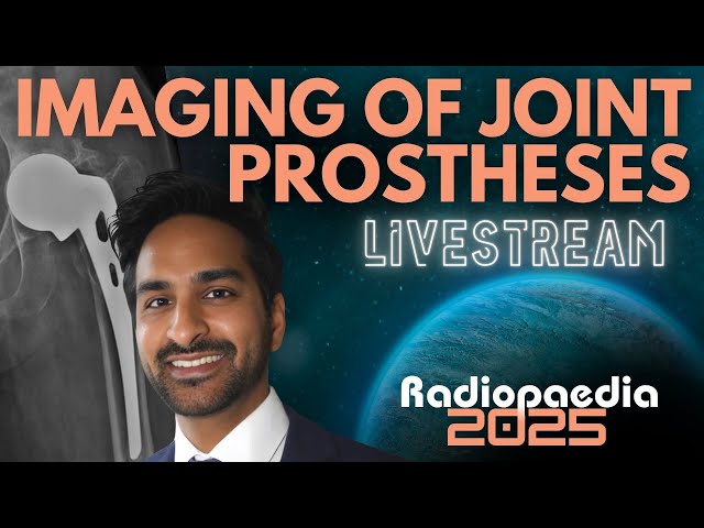 Imaging of Joint Prostheses