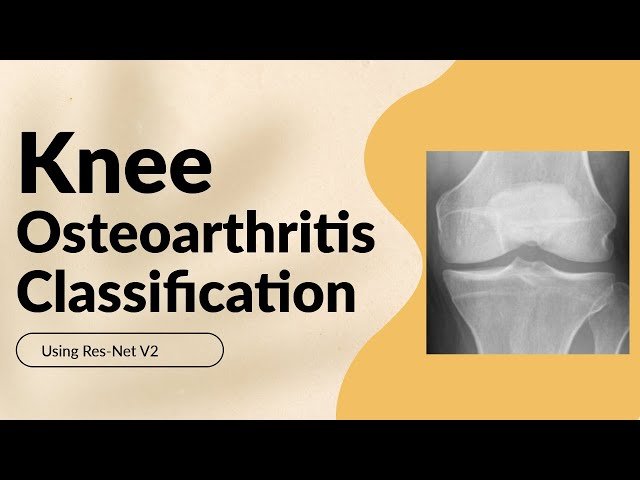 Knee Osteoarthritis Detection and Classification using ResNet