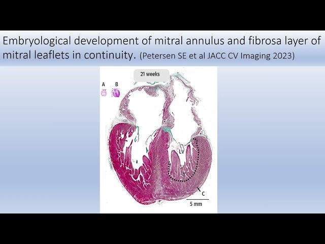 Cardiovascular Grand Rounds - January 22, 2026