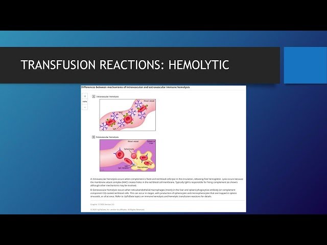 Intraoperative and Postoperative Management Keyword Review